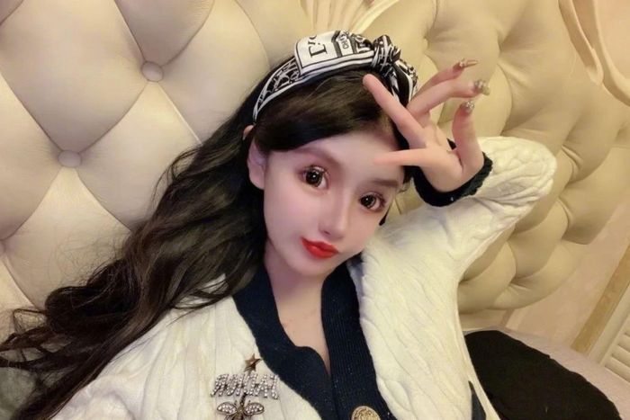 Zhou Chuna trải qua ca phẫu thuật thẩm mỹ đầu tiên lúc 13 tuổi.