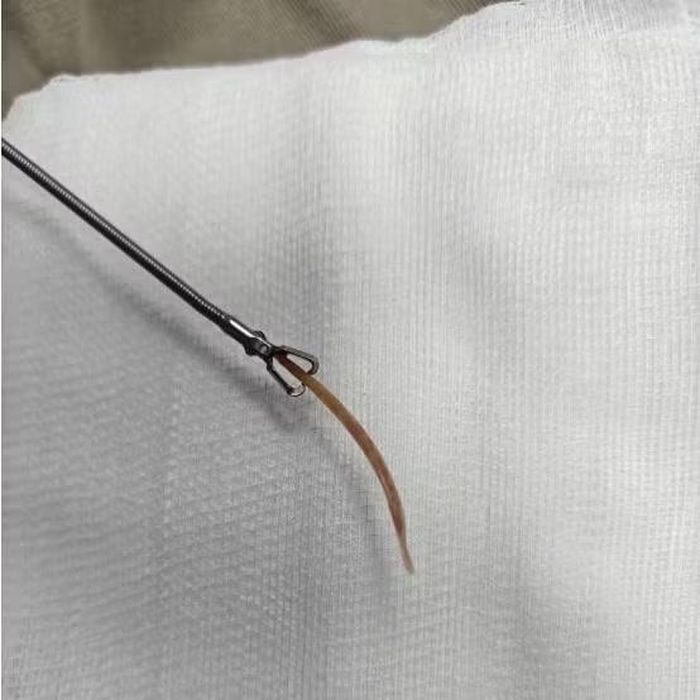 Tăm tre được lấy ra - Ảnh BVCC