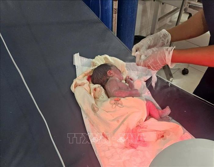 Bé gái nặng 2,5kg được các y, bác sĩ Sư đoàn 4 cấp cứu, chăm sóc kịp thời. Ảnh: TTXVN phát