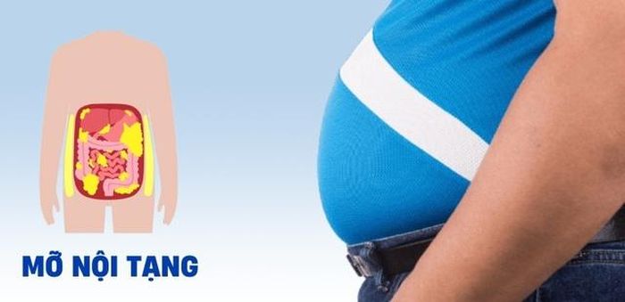 Dư thừa mỡ nội tạng là mối nguy hiểm tiềm ẩn đối với sức khỏe, có thể dẫn đến nhiều bệnh lý nghiêm trọng như tim mạch, tiểu đường và ung thư.