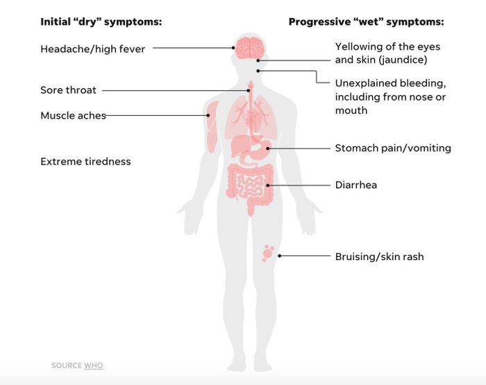 Người mắc Ebola thường khởi phát với các triệu chứng giống cúm như sốt cao, đau đầu và đau cơ, trước khi tiến triển sang các biểu hiện nghiêm trọng hơn như nôn mửa, tiêu chảy, xuất huyết và tổn thương đa cơ quan.