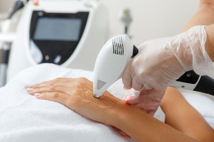 Nhiều phương pháp trẻ hóa da mặt hiện nay cũng có thể được áp dụng cho đôi tay.