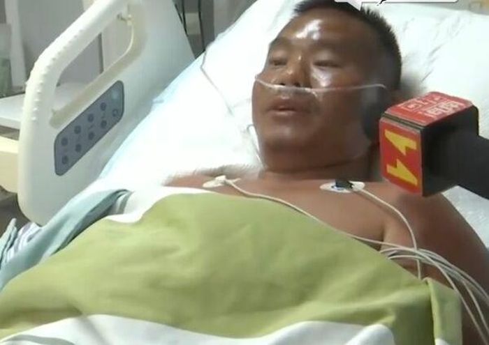 Nắng gay gắt khiến làn da của ông bị bỏng nặng.