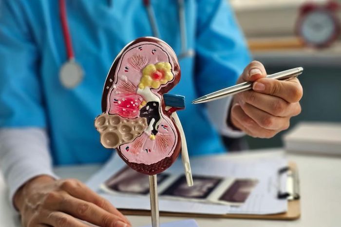 Các bác sĩ giải thích sỏi bàng quang thường hình thành khi nước tiểu tồn đọng quá lâu trong bàng quang. Ảnh: Shutterstock