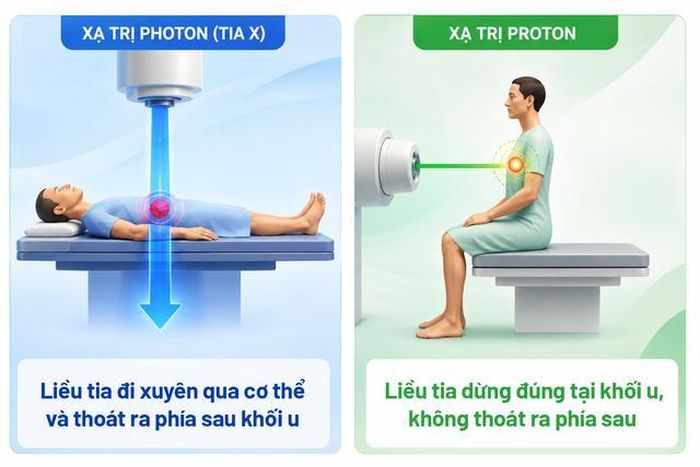So sánh xạ trị proton tư thế ngồi với tia xạ biết "dừng đúng chỗ" để tiêu diệt khối u với xạ trị photon (tia X) "đi xuyên qua" phía sau.