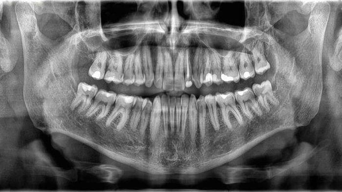 Thoạt nhìn, răng và xương có vẻ giống nhau. (Nguồn: Getty Images)