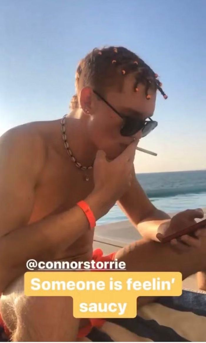 Hình ảnh Connor Storrie tết tóc cornrow đang lan truyền trên mạng xã hội.