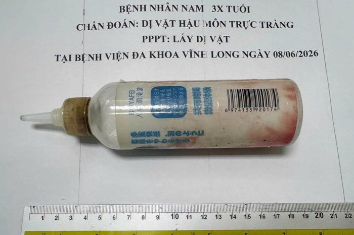 Dị vật chai nhựa được lấy ra khỏi trực tràng nam bệnh nhân 34 tuổi với kích thước lớn. Ảnh: BVCC.