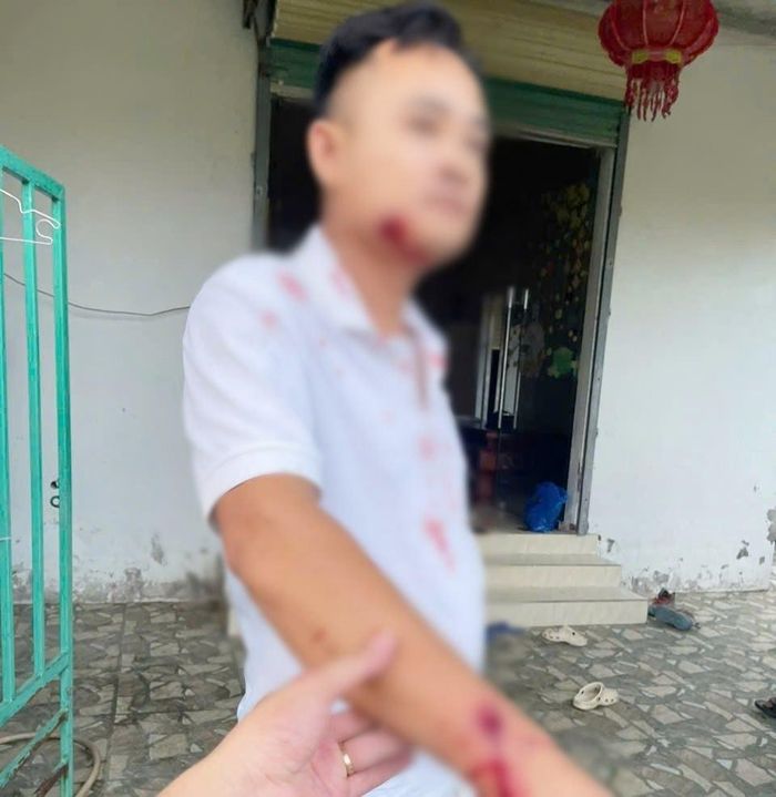 Anh Trần Đình T. bị nhiều vết thương trên cơ thể.