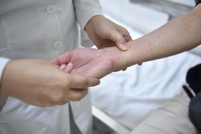 Bệnh nhân được chẩn đoán mắc sốt xuất huyết cùng triệu chứng phát ban đỏ điển hình. Ảnh: Trương Hiếu.