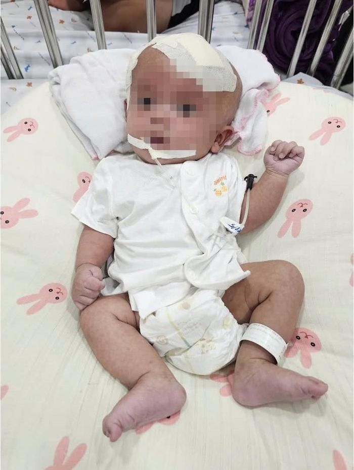 Sau một tuần hồi sức và chăm sóc hậu phẫu, sức khỏe bệnh nhi phục hồi tốt, tỉnh táo, ổn định và được xuất viện.