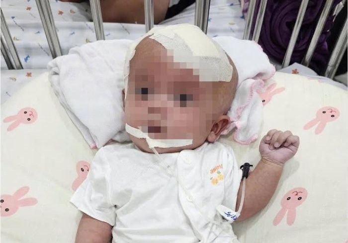  Bệnh nhi cần phải hóa trị bổ trợ sau ca phẫu thuật. 