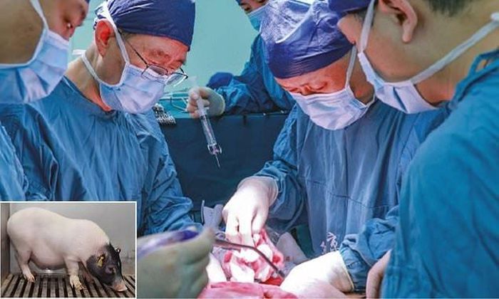 Các bác sĩ đã thực hiện ca ghép dị chủng kết hợp đầu tiên trên thế giới, đưa một lá gan và hai quả thận từ lợn biến đổi gene vào cơ thể người. Ảnh minh họa: SCMP