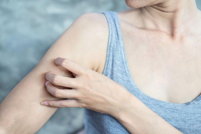 Mẩn ngứa có thể do tình trạng da nhạy cảm với ánh sáng do dùng thuốc.