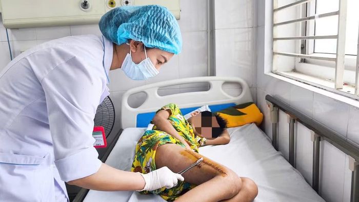 Chăm sóc vết thương cho bệnh nhi sau phẫu thuật - Ảnh BVCC