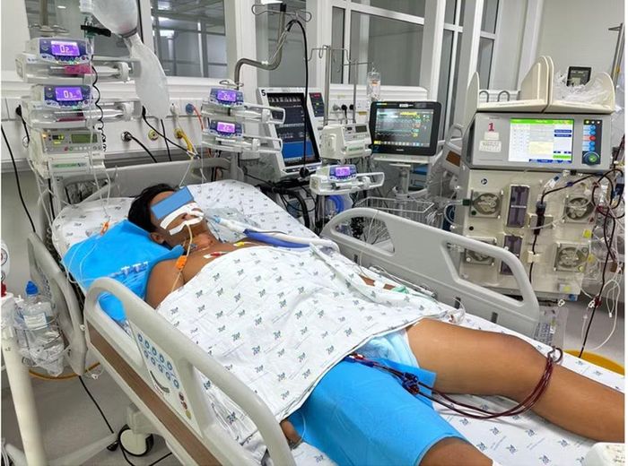 Bệnh nhi Tr.X.V. nhập viện trong tình trạng sốc nhiệt nặng, kèm tổn thương gan, tụy, thận cấp và được điều trị tích cực bằng thở máy, chống sốc, lọc máu liên tục. Ảnh: BVCC.