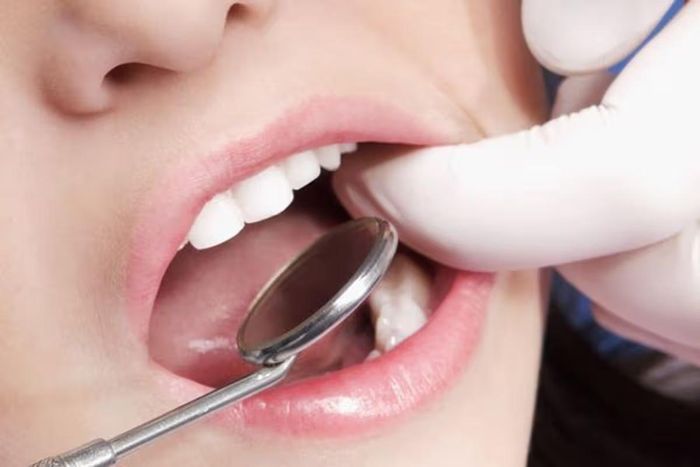  Khoảng 80-90% trường hợp hôi miệng có nguyên nhân từ chính khoang miệng. Ảnh: Shutterstock. 