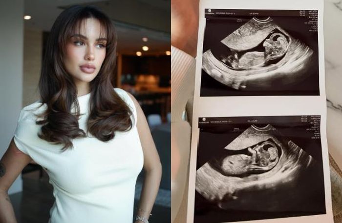 Cuối tháng 4, Celeste Cortesi thông báo đã mang thai con đầu lòng với bạn trai Jonathan Sterling. Ảnh: Instagram.