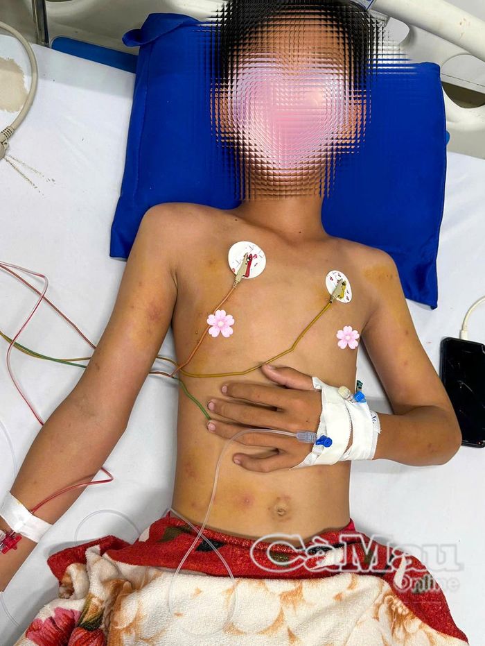 Bệnh nhi được các y, bác sĩ Bệnh viện Sản - Nhi Cà Mau theo dõi, điều trị tích cực.