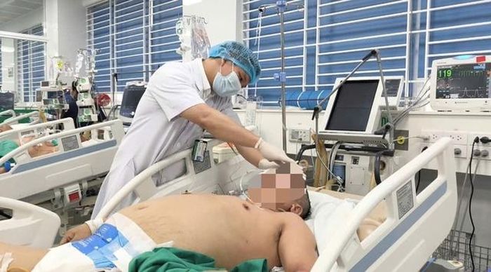 Bệnh nhân bất ngờ ngã quỵ, xuất huyết não nghiêm trọng ngay sau một trận nhậu. Ảnh: BVCC