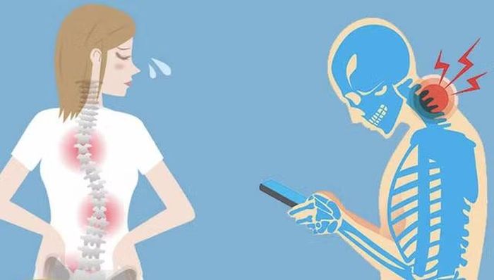 Các chuyên gia gọi tình trạng này là “hội chứng cổ công nghệ”, một vấn đề sức khỏe đang ngày càng phổ biến ở người trẻ tuổi. Những cơn đau cổ, đau vai gáy kéo dài không chỉ gây khó chịu trong sinh hoạt hằng ngày mà còn có thể ảnh hưởng đến chất lượng giấc ngủ và hiệu suất làm việc nếu không được điều chỉnh kịp thời.