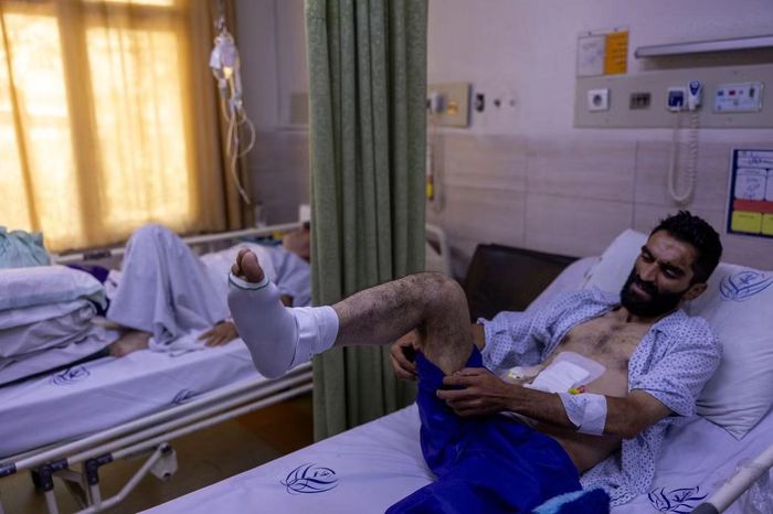 Người Iran phải nhập viện điều trị sau khi bị thương trong đợt không kích của Mỹ và Israel. Ảnh: Gett Images.