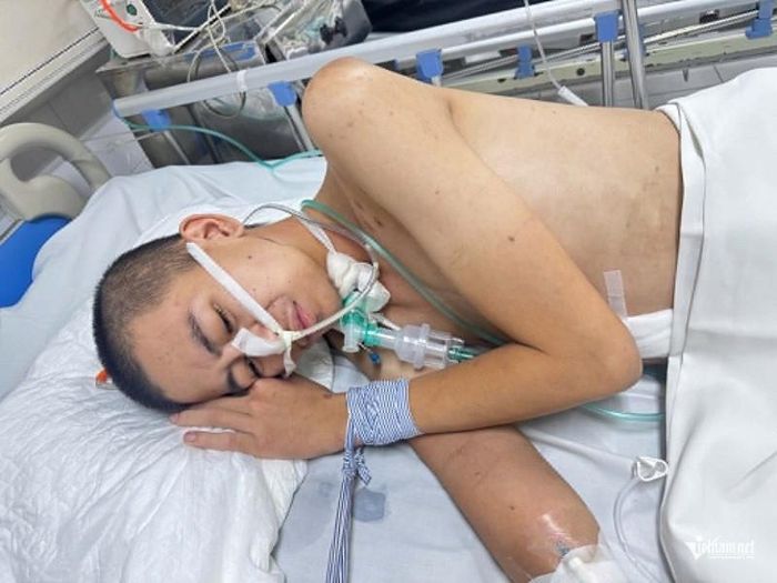 Di chứng để lại sau vụ tai nạn khiến Huy phải nằm viện điều trị lâu dài tốn kém