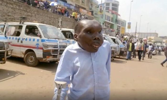 Năm 2002, Godfrey tham gia một cuộc thi mang tên "Người đàn ông xấu xí nhất thế giới" tại Uganda và giành giải nhất. Ảnh: TLC