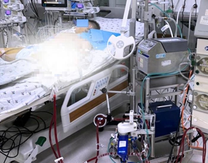 Bệnh nhi nguy kịch vì viêm cơ tim tối cấp sau 2 ngày sốt nhẹ, tự điều trị tại nhà. Ảnh: BVCC.