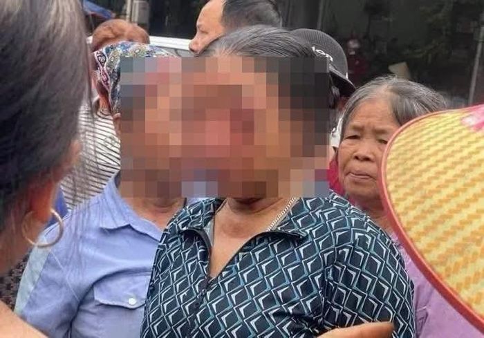Sau khi ghi nhận vụ việc, làm việc với các bên liên quan, lực lượng Công an phường Xuân Hòa hỗ trợ đưa nạn nhân tới Bệnh viện Mắt Trung ương để cấp cứu, điều trị.