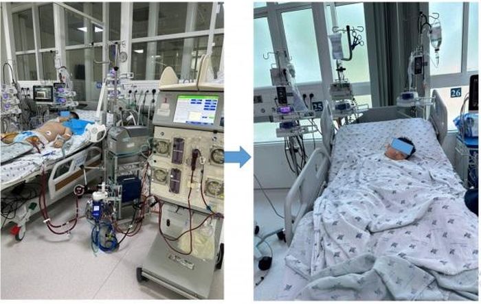 Bệnh nhi viêm cơ tim tối cấp, sốc tim được điều trị tích cực tại bệnh viện. Ảnh: BVCC