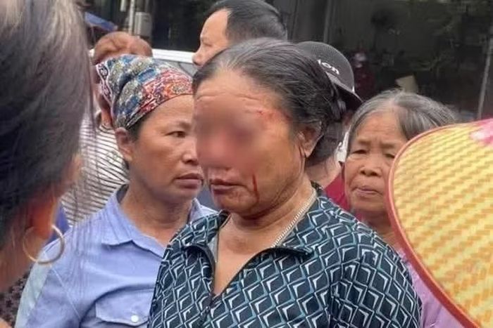 Người phụ nữ bán rau bị thương ở mặt sau khi bị vòi nước áp lực cao xịt vào người.