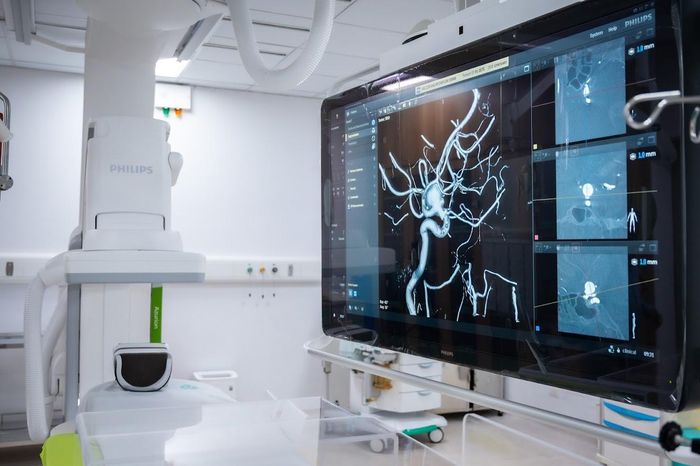  Nhờ đó, bác sĩ có thể nâng cao độ chính xác trong các kỹ thuật chuyên sâu như can thiệp đột quỵ, nút mạch điều trị xuất huyết, can thiệp tim mạch hay xử lý dị dạng mạch máu phức tạp, đồng thời giảm lượng tia X và thuốc cản quang sử dụng cho người bệnh.