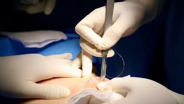 Một ca phẫu thuật cho người bệnh với sự hỗ trợ của công nghệ định vị không dây