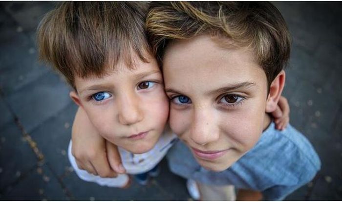 2 anh em Mehmet Selman và Kerem Selman với cặp mắt cực hiếm