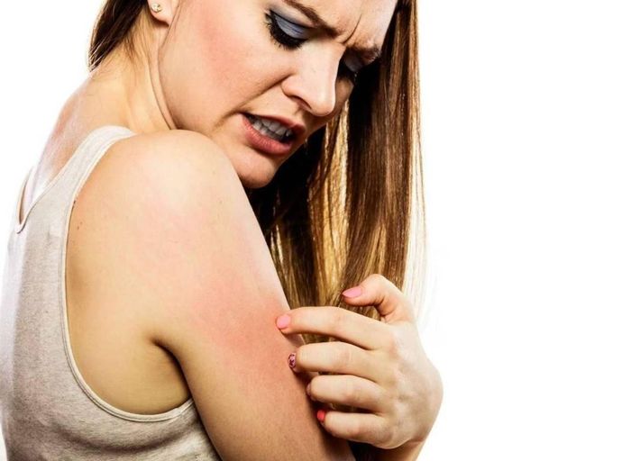 Da cánh tay thay đổi màu sắc bất thường. Ảnh minh họa