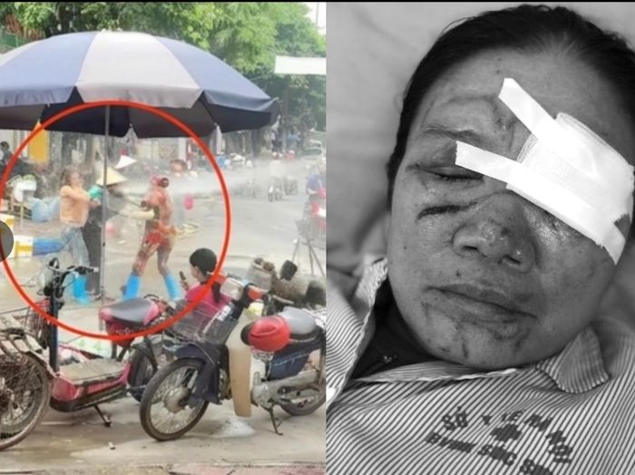 Hình ảnh vụ việc xảy ra và thương tích của nạn nhân.