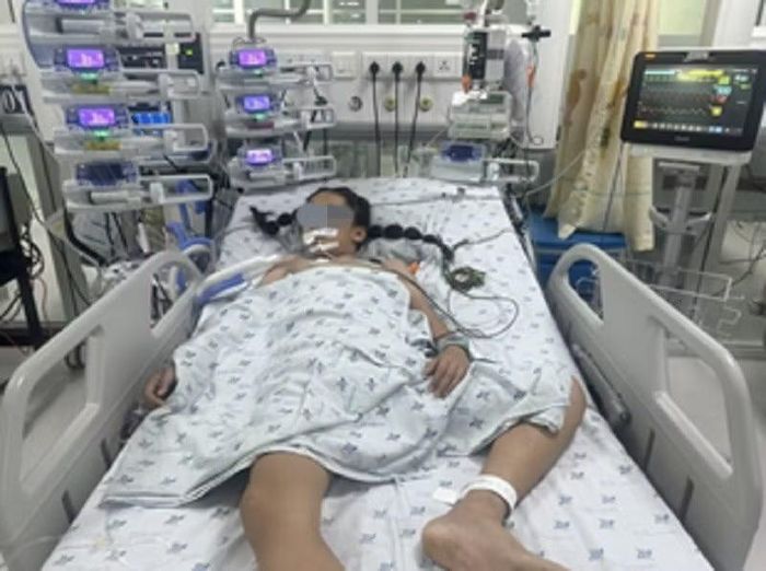 Bệnh nhi T.T.A. (11 tuổi, An Giang) được chuyển đến bệnh viện trong tình trạng tím tái, lơ mơ. Ảnh: BVCC