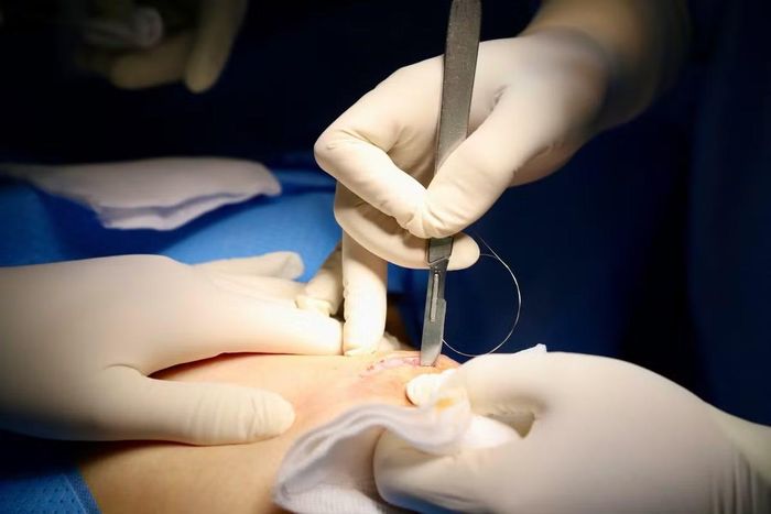 Chính xác đến từng mm là ưu điểm vượt trội của định vị không dây phát hiện sớm tổn thương vú - Ảnh BVCC