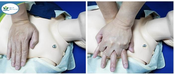 Ép tim ngoài lồng ngực sơ cứu trẻ đuối nước