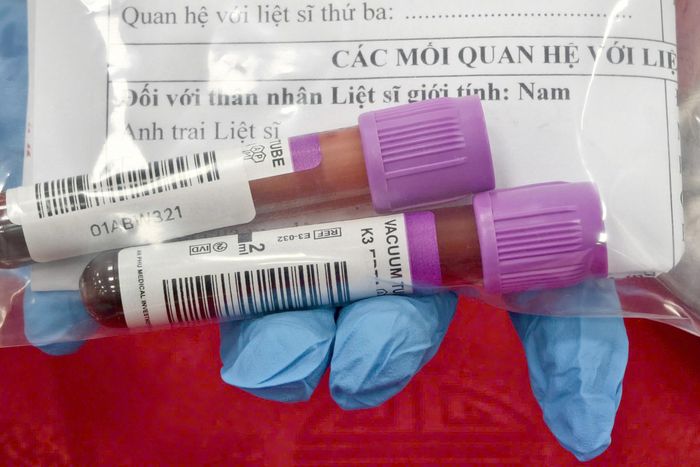 Mỗi mẫu sinh phẩm ADN được thu nhận không chỉ là dữ liệu khoa học phục vụ công tác đối sánh, xác định danh tính hài cốt liệt sĩ, mà còn là niềm hy vọng để các gia đình có thêm cơ hội tìm lại thông tin về người thân đã anh dũng hy sinh vì độc lập, tự do của Tổ quốc.