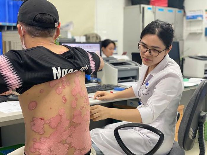 Bác sĩ thăm khám cho một trường hợp mắc vảy nến.