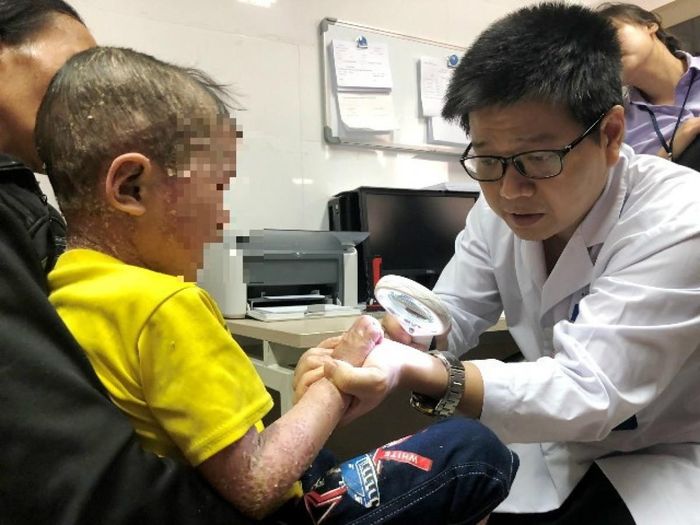 PGS.TS.BS Lê Hữu Doanh khám bệnh cho bệnh nhân bị biến chứng vảy nến nặng
