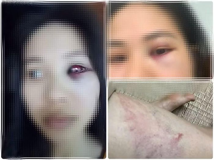 Một số hình ảnh trên bài đăng được cho là của người vợ tố thầy giáo bạo hành.