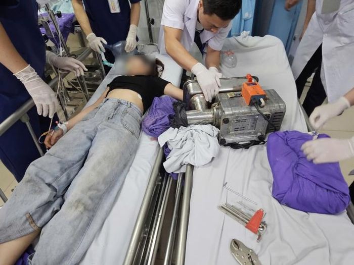 Bệnh nhân bị tổn thương bàn tay nghiêm trọng được cấp cứu tại Bệnh viện Bãi Cháy.