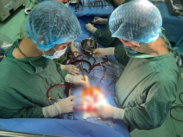 Ê-kíp phẫu thuật Bệnh viện HNĐK Nghệ An thực hiện ca thay van và gốc động mạch chủ cho người bệnh mắc bệnh lý tim mạch phức tạp.