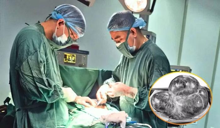 Các bác sĩ thực hiện phẫu thuật, loại bỏ khối u lớn.
