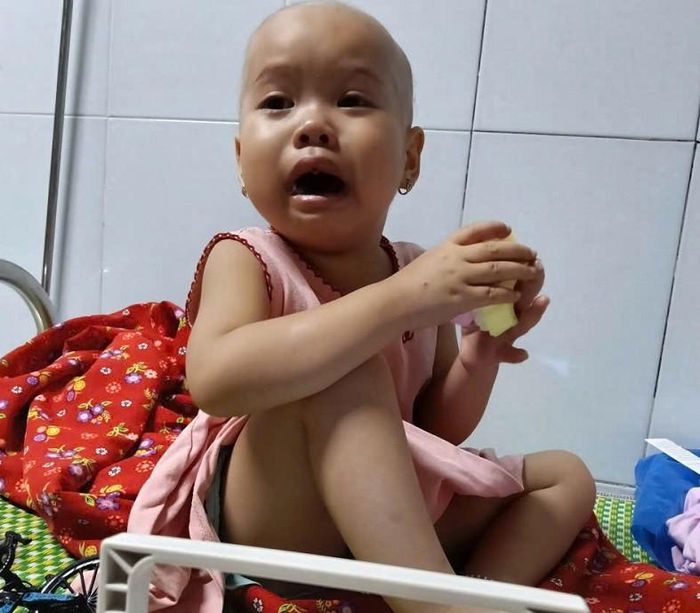 Sau những đợt điều trị hóa trị, tóc của bé Vân rụng gần hết