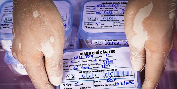Mẫu được bảo quản trong điều kiện tiêu chuẩn.