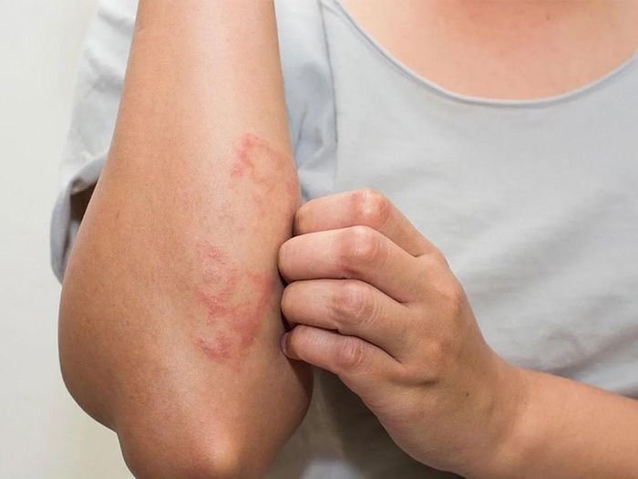 Nếu xử lý vết thương không đúng, bạn có thể làm tăng nguy cơ nhiễm trùng, viêm nặng hoặc để lại sẹo sau khi lành